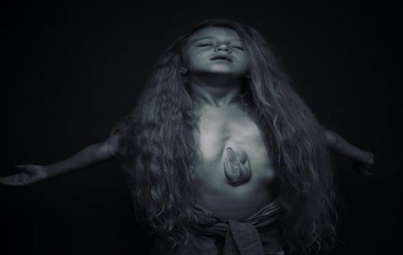 The girl whose heart beats outside her body  The girl whose heart beats outside her body