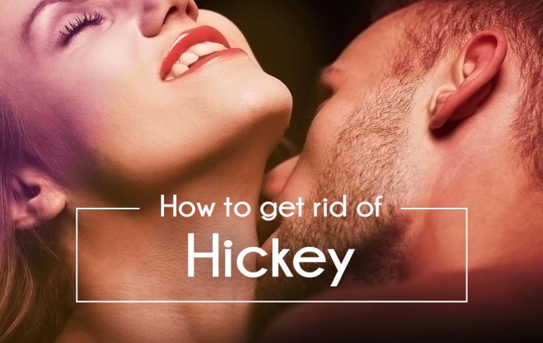 To get hickey a rid most way of effective 15 Best